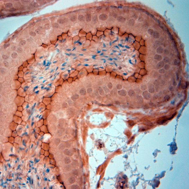 ZO1 Antibody in Immunohistochemistry (Paraffin) (IHC (P))