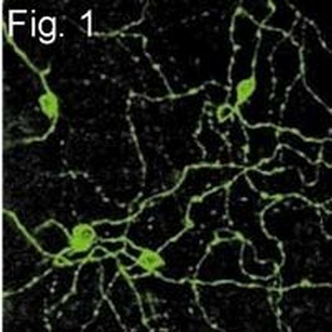 Opsin 4 Antibody in Immunocytochemistry (ICC/IF)