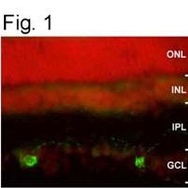 Opsin 4 Antibody in Immunocytochemistry (ICC/IF)