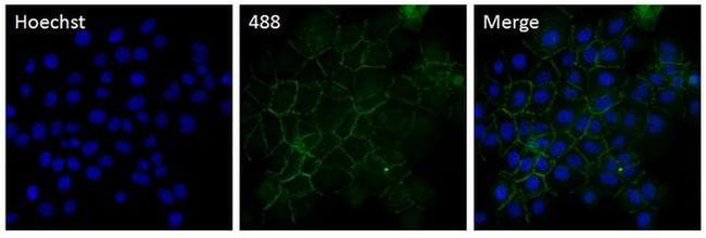 P-cadherin Antibody in Immunocytochemistry (ICC/IF)