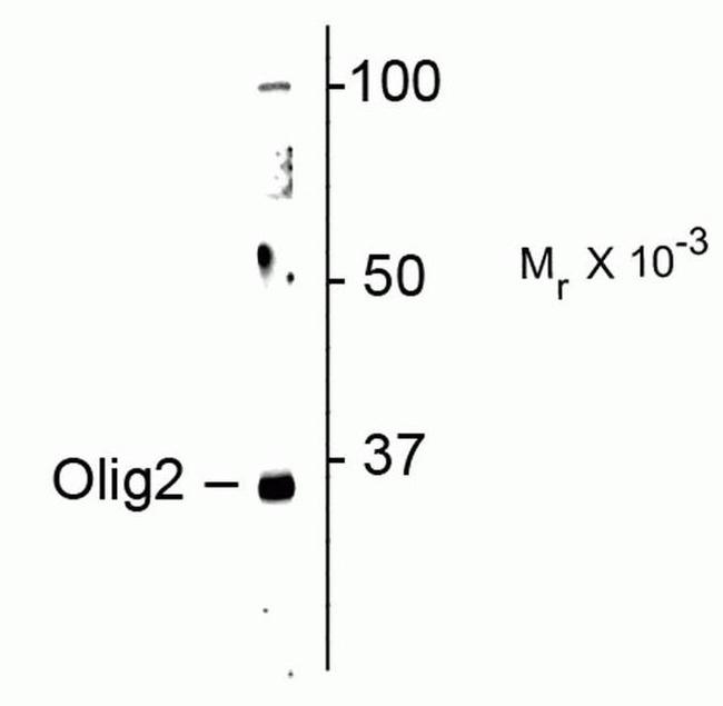 OLIG2 Antibody in Western Blot (WB)