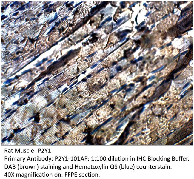 P2Y1 Antibody in Immunohistochemistry (IHC)