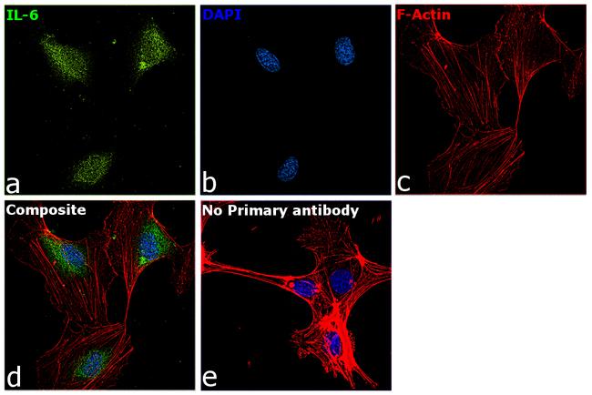 IL-6 Antibody in Immunocytochemistry (ICC/IF)