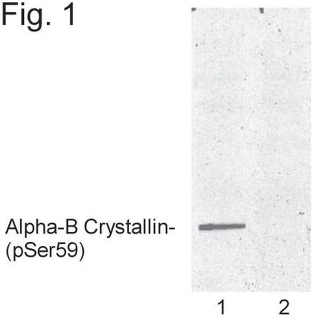 Phospho-CRYAB (Ser59) Antibody in Western Blot (WB)