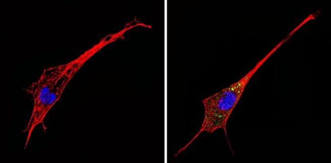 alpha-1a Adrenergic Receptor Antibody in Immunocytochemistry (ICC/IF)