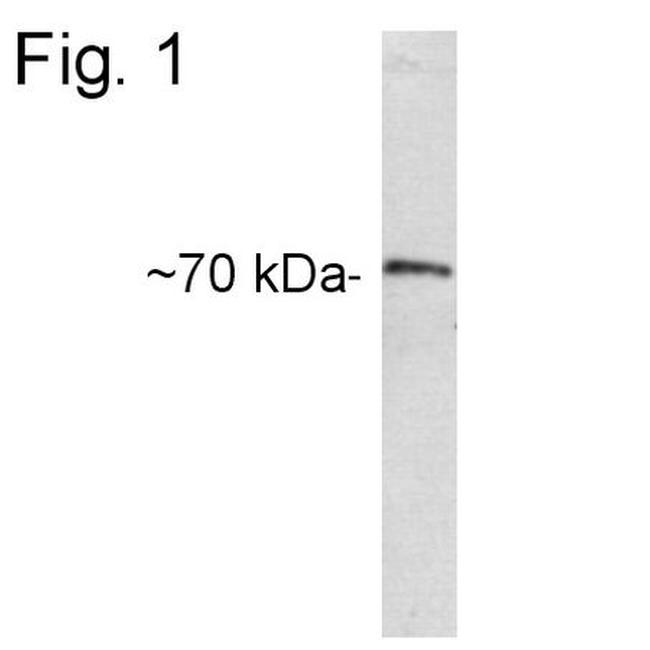 CETP Antibody in Western Blot (WB)