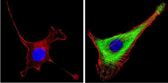 Leptin Antibody in Immunocytochemistry (ICC/IF)