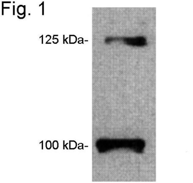 Leptin Receptor Antibody in Western Blot (WB)