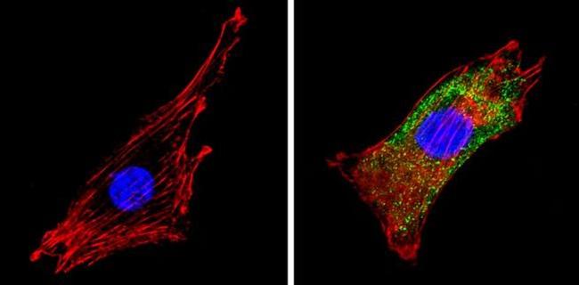 COPII Antibody in Immunocytochemistry (ICC/IF)