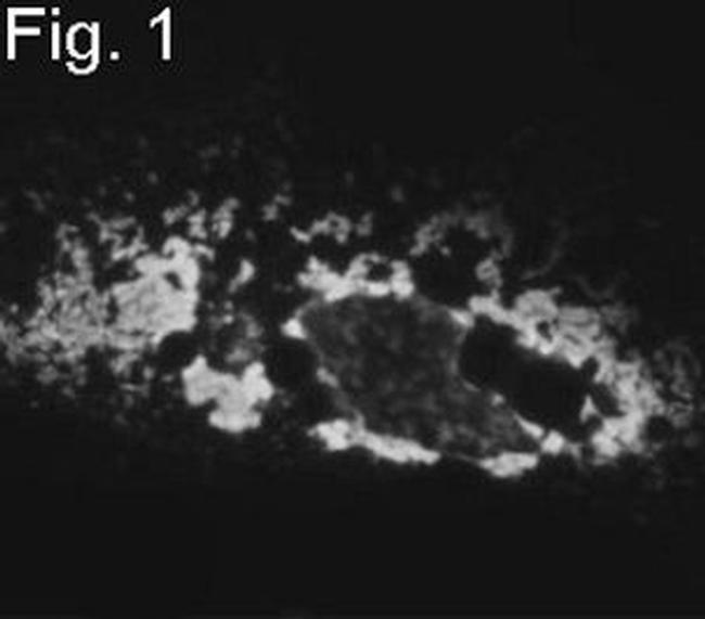 PICK1 Antibody in Immunocytochemistry (ICC/IF)