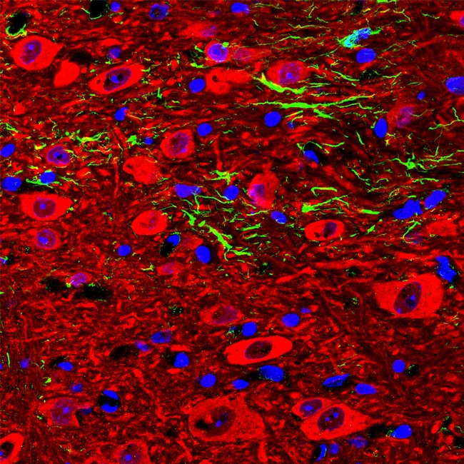 NSE Antibody in Immunocytochemistry (ICC/IF)