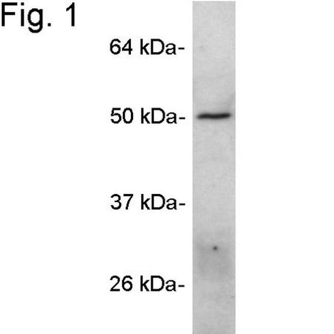 ANGPTL4 Antibody in Western Blot (WB)