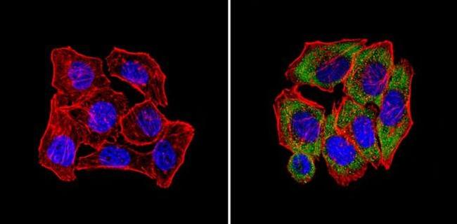 CPEB1 Antibody in Immunocytochemistry (ICC/IF)