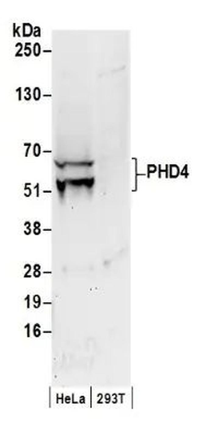 P4HTM Antibody in Western Blot (WB)