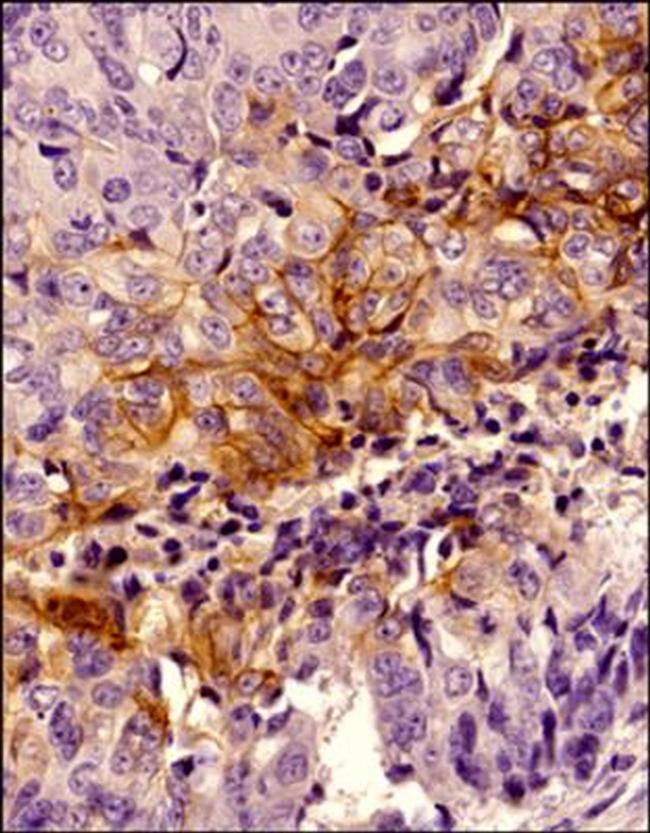 Carbonic Anhydrase IX Antibody in Immunohistochemistry (Paraffin) (IHC (P))