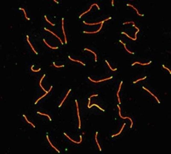 SCP3 Antibody in Immunocytochemistry (ICC/IF)