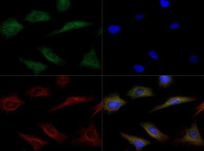 LIPG Antibody in Immunocytochemistry (ICC/IF)