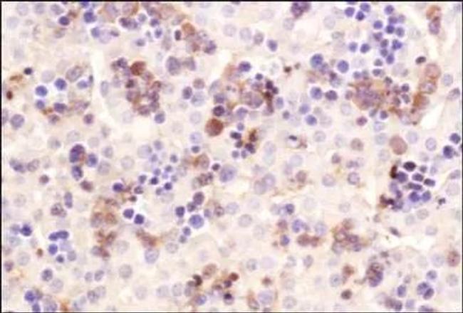 ChREBP Antibody in Immunohistochemistry (Paraffin) (IHC (P))