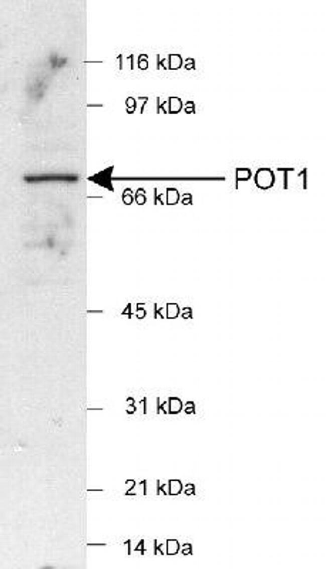 POT1 Antibody in Western Blot (WB)