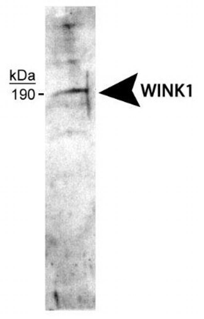 WNK1 Antibody in Western Blot (WB)