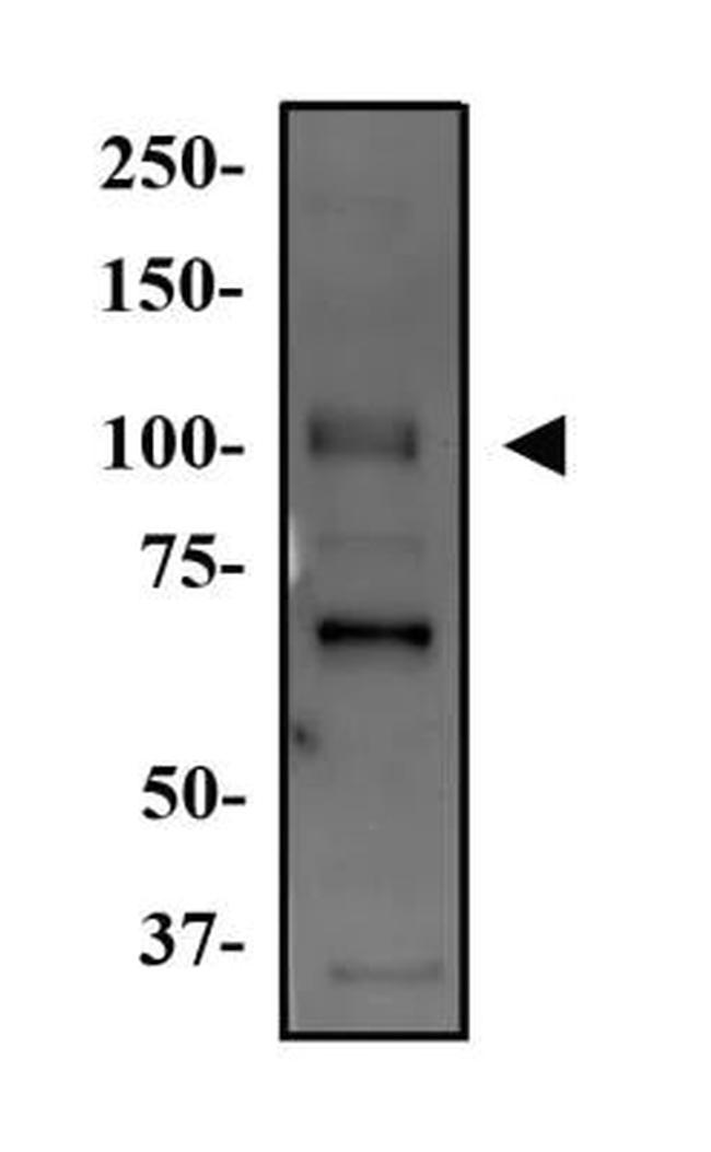 WNK4 Antibody in Western Blot (WB)