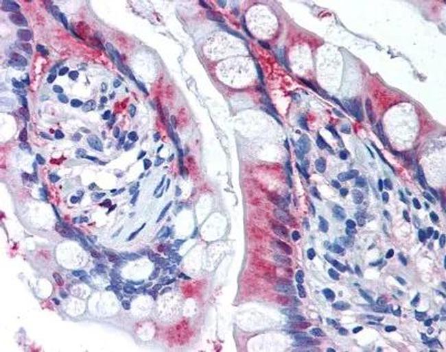 SLC7A11 Antibody in Immunohistochemistry (Paraffin) (IHC (P))