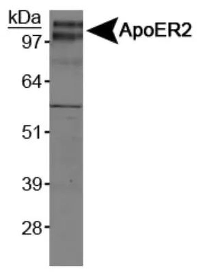 LRP8 Antibody in Western Blot (WB)