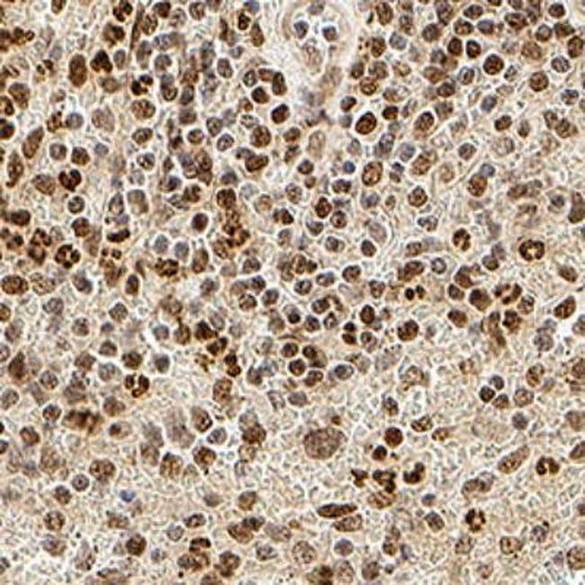 Phospho-IRE1 alpha (Ser724) Antibody in Immunohistochemistry (Paraffin) (IHC (P))