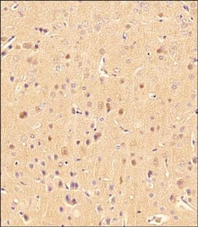 LC3B Antibody in Immunohistochemistry (Paraffin) (IHC (P))