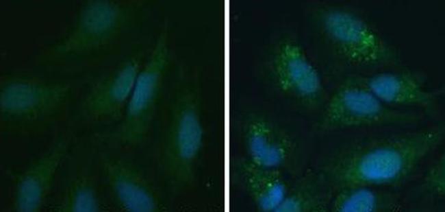 LC3A/LC3B Antibody in Immunocytochemistry (ICC/IF)