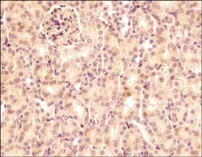 SEMA3B Antibody in Immunohistochemistry (Paraffin) (IHC (P))