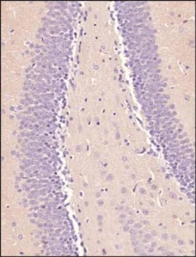 OCT4 Antibody in Immunohistochemistry (Paraffin) (IHC (P))