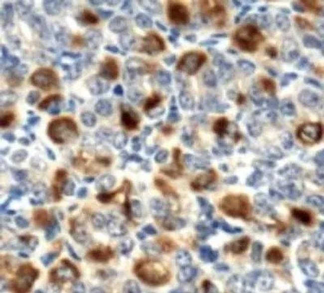 LOX Antibody in Immunohistochemistry (Paraffin) (IHC (P))