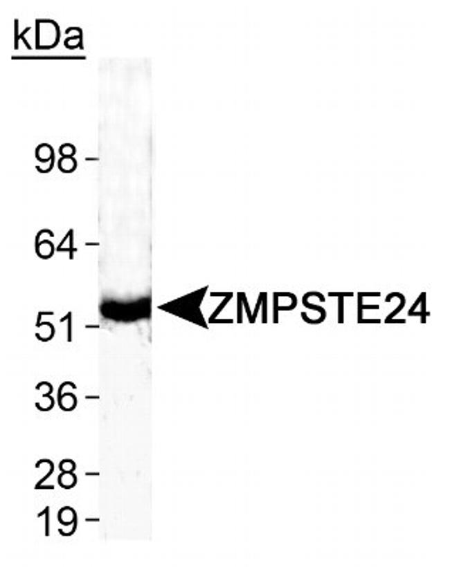 ZMPSTE24 Antibody in Western Blot (WB)