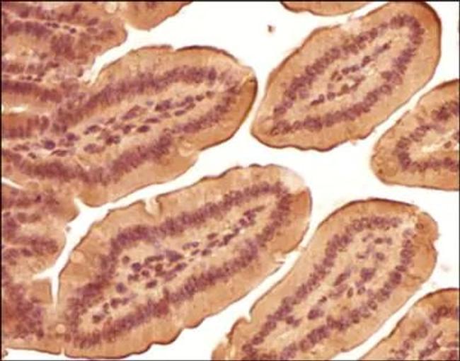 LOX Antibody in Immunohistochemistry (Paraffin) (IHC (P))