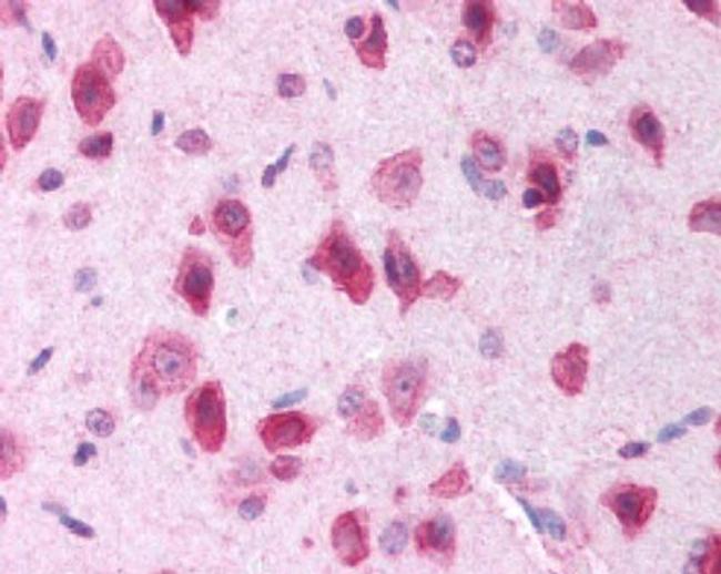 LRRK2 Antibody in Immunohistochemistry (Paraffin) (IHC (P))