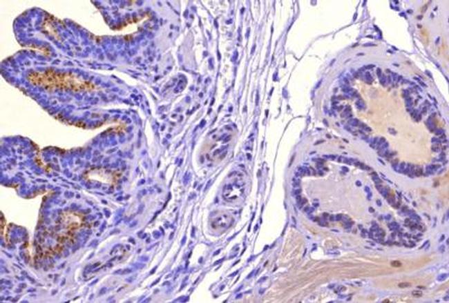 SAT1 Antibody in Immunohistochemistry (Paraffin) (IHC (P))