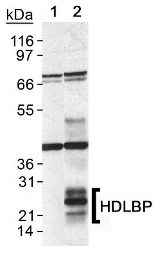 GPIHBP1 Antibody in Western Blot (WB)