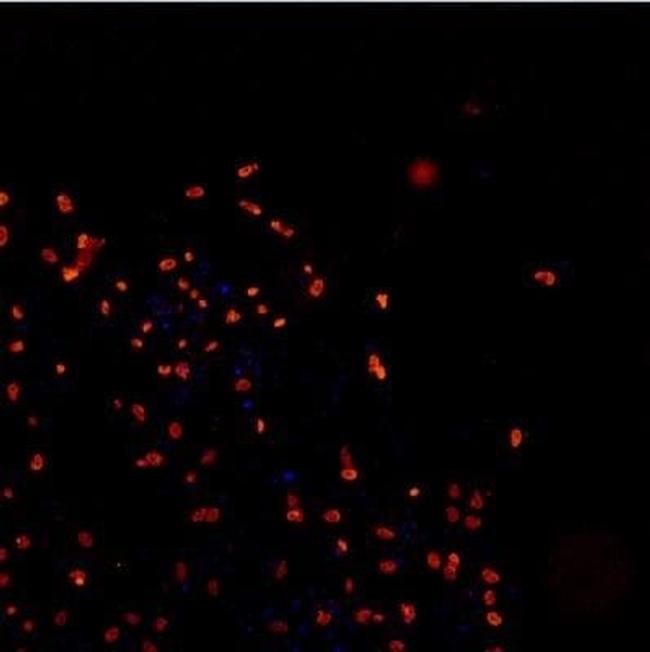 TDP-43 Antibody in Immunocytochemistry (ICC/IF)