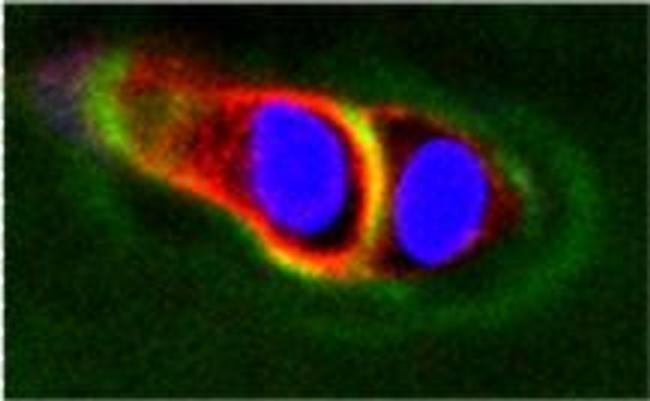 ADAMTS5 Antibody in Immunocytochemistry (ICC/IF)