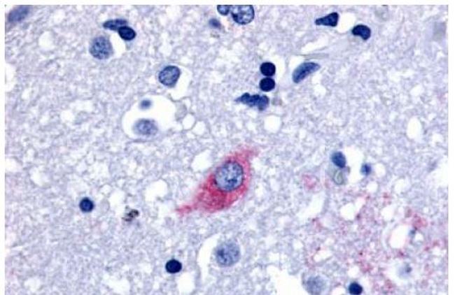 LGR4 Antibody in Immunohistochemistry (Paraffin) (IHC (P))