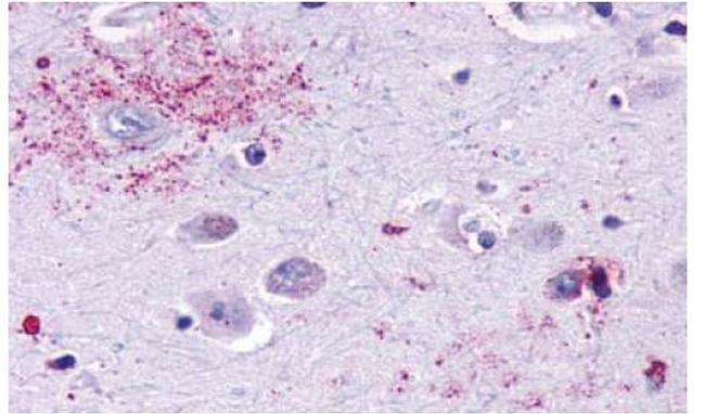 MAS1 Antibody in Immunohistochemistry (Paraffin) (IHC (P))