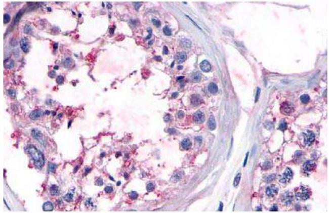 OR10R2 Antibody in Immunohistochemistry (Paraffin) (IHC (P))