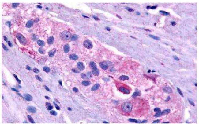 Prokineticin Receptor 1 Antibody in Immunohistochemistry (Paraffin) (IHC (P))