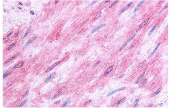 HTR1B Antibody in Immunohistochemistry (Paraffin) (IHC (P))