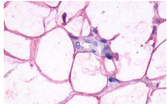 beta-3 Adrenergic Receptor Antibody in Immunohistochemistry (Paraffin) (IHC (P))