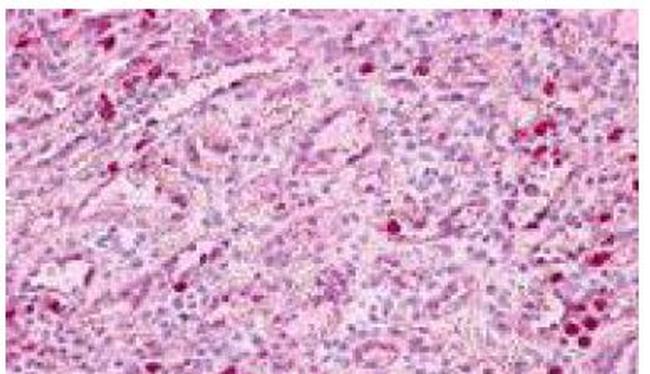 PTAFR Antibody in Immunohistochemistry (Paraffin) (IHC (P))