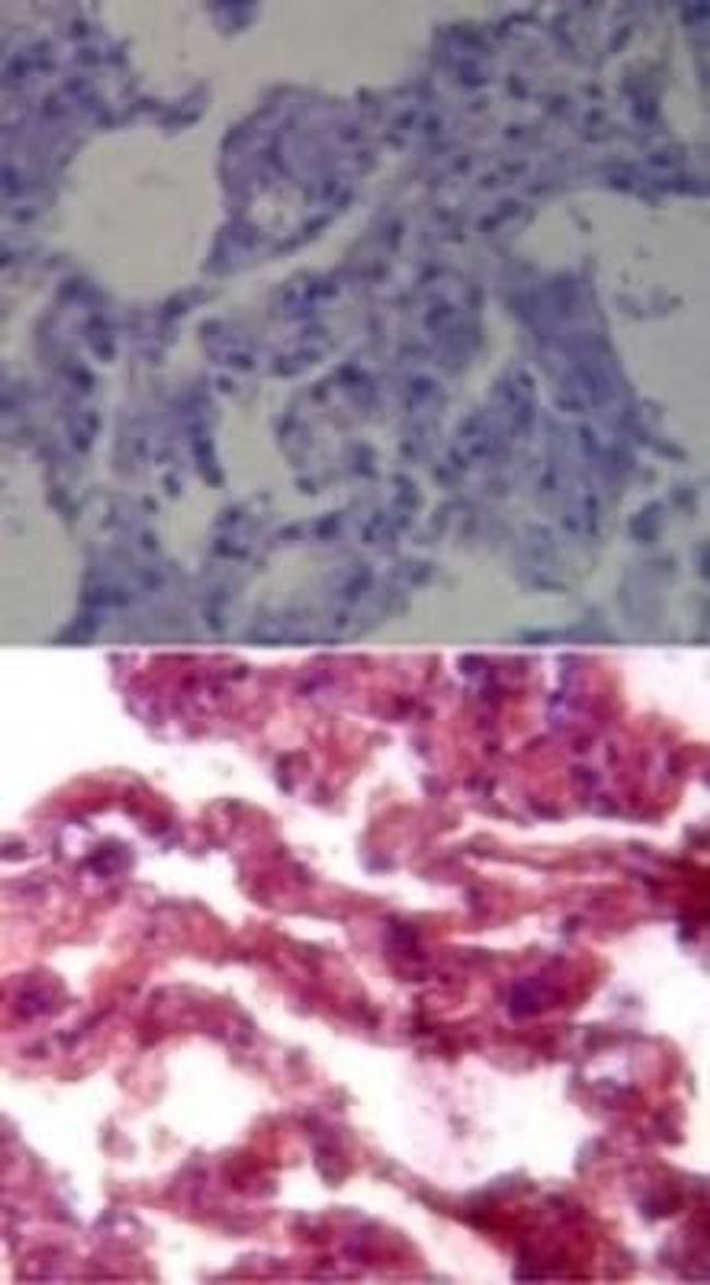 TLR7 Antibody in Immunohistochemistry (Paraffin) (IHC (P))