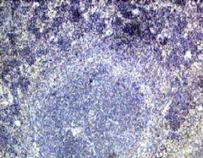 IFNLR1 Antibody in Immunohistochemistry (Paraffin) (IHC (P))