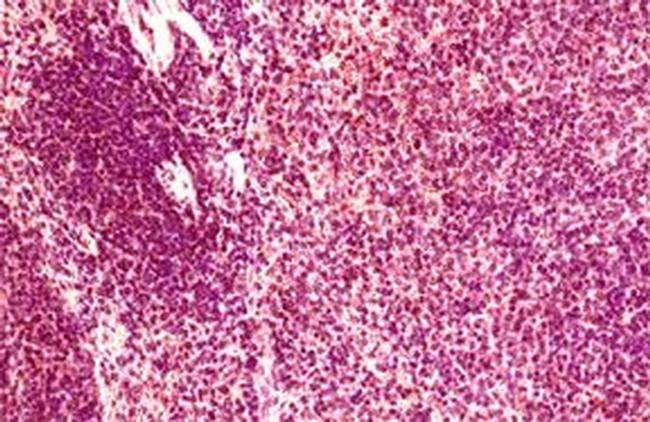 CCR6 Antibody in Immunohistochemistry (IHC)